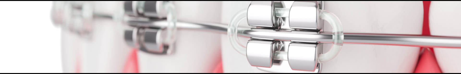 orthodontie Senlis